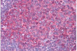 Human Tonsil: Formalin-Fixed, Paraffin-Embedded (FFPE) (Hsc70 antibody  (AA 143-192))