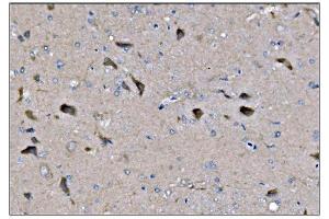 IHC analysis of Dynamin 3/DNM3 using anti-Dynamin 3/DNM3 antibody (ABIN7601163). (Dynamin 3 antibody  (AA 295-712))