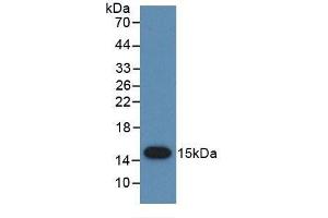 Detection of Recombinant PSCA, Human using Monoclonal Antibody to Prostate Stem Cell Antigen (PSCA) (PSCA antibody  (AA 22-95))