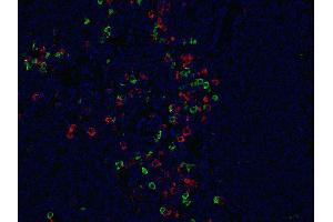 Indirect immunostaining of formalin-fixed paraffin embedded human tonsil section with anti-λ light chain (dilution 1 : 200; green) and mouse anti-κ light chain (cat.