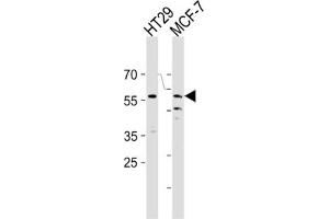 Western Blotting (WB) image for anti-Cell Division Cycle 7 (CDC7) antibody (ABIN3003260) (CDC7 antibody)
