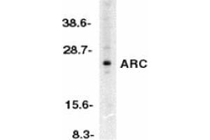 Image no. 1 for anti-Nucleolar Protein 3 (Apoptosis Repressor with CARD Domain) (NOL3) antibody (ABIN203569) (NOL3 antibody)