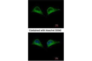 ICC/IF Image Immunofluorescence analysis of methanol-fixed HeLa, using PSMD7, antibody at 1:500 dilution. (PSMD7 antibody)