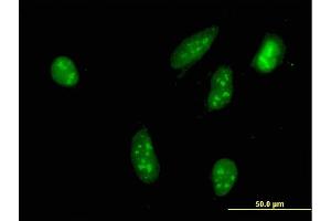 Immunofluorescence of monoclonal antibody to RPS6KA2 on HeLa cell. (RPS6KA2 antibody  (AA 631-733))