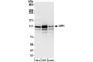 Western Blotting (WB) image for anti-Huntingtin Interacting Protein 1 (HIP1) (AA 725-775) antibody (ABIN7449886)