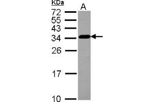 Western Blotting (WB) image for anti-Tubulin Folding Cofactor B (TBCB) (AA 1-219) antibody (ABIN1501321) (TBCB antibody  (AA 1-219))