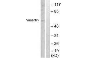Western blot analysis of extracts from A549 cells, treated with Nocodazole 1ug/ml 16h, using Vimentin (Ab-56) Antibody. (Vimentin antibody  (AA 31-80))