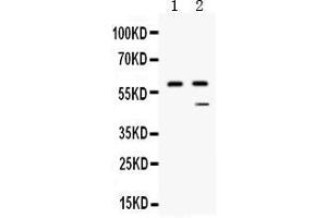 Western blot analysis of CPB2 expression in human placenta extract ( Lane 1) and HEPG2 whole cell lysates ( Lane 2).