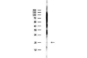anti-Chromosome 12 Open Reading Frame 65 (C12orf65) antibody