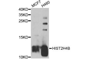 Western blot analysis of extracts of various cell lines, using HIST2H4B antibody (ABIN5974305) at 1/1000 dilution.
