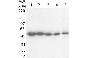 Western blot using  Anti-Tetanus Toxin C antibody shows detection of a band at ~52 kDa corresponding to full length 6X His-TTFC fusion protein (arrowhead). (Tetanus Toxin C-Fragment (TTC) antibody)
