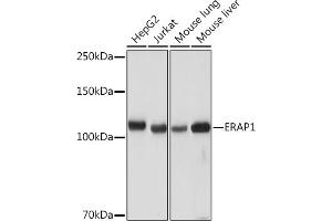 Western blot analysis of extracts of various cell lines, using ER Rabbit mAb (ABIN7266941) at 1:1000 dilution. (ERAP1 antibody)