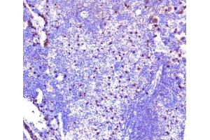 IHC analysis of CXCL12 using anti-CXCL12 antibody (ABIN6719467). (CXCL12 antibody  (AA 24-93))