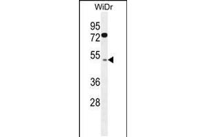 Western blot analysis in WiDr cell line lysates (35ug/lane). (RMD1 antibody  (N-Term))