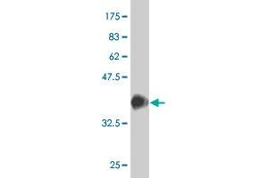 Western Blot detection against Immunogen (37. (SRF antibody  (AA 406-508))