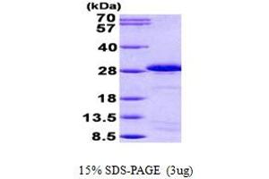 SDS-PAGE (SDS) image for Sperm Autoantigenic Protein 17 (SPA17) (AA 1-151) protein (His tag) (ABIN5852921)
