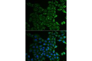 Immunofluorescence analysis of U2OS cells using C21orf33 antibody. (C21orf33 antibody  (AA 42-268))