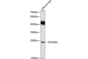 Western blot analysis of extracts of mouse eye, using ZF Antibody (ABIN6130935, ABIN6150428, ABIN6150429 and ABIN6217088) at 1:1000 dilution. (ZFAND5 antibody  (AA 40-150))