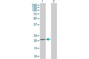 Western Blot analysis of PRDX5 expression in transfected 293T cell line by PRDX5 MaxPab polyclonal antibody. (Peroxiredoxin 5 antibody  (AA 1-214))