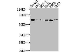 Western Blot Positive WB detected in: Jurkat whole cell lysate, 293 whole cell lysate, MCF-7 whole cell lysate, Hela whole cell lysate, K562 whole cell lysate, HL60 whole cell lysate All lanes: PTPN11 antibody at 1:2000 Secondary Goat polyclonal to rabbit IgG at 1/50000 dilution Predicted band size: 69, 53 kDa Observed band size: 69 kDa (Recombinant PTPN11 antibody)