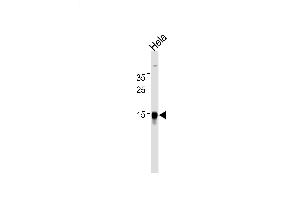 Lane 1: HeLa Cell lysates, probed with CDA (921CT14. (CDA antibody)