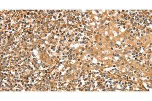 Immunohistochemistry of paraffin-embedded Human tonsil tissue using SLC8A3 Polyclonal Antibody at dilution 1:35 (SLC8A3 antibody)