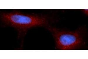 Immunofluorescence (IF) image for anti-Poly Binding Protein Interacting Protein 2 (PAIP2) (AA 1-127) antibody (PE) (ABIN5568398) (PAIP2 antibody  (AA 1-127) (PE))