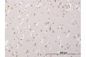 Immunoperoxidase of monoclonal antibody to ALPK3 on formalin-fixed paraffin-embedded human cerebral cortex. (ALPK3 antibody  (AA 1811-1906))