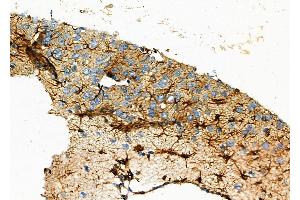 ABIN6257365 and ABIN6273845 at 1/100 staining Rat brain tissue by IHC-P. (OR51A1P antibody)