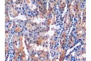 Detection of MCP1 in Rabbit Kidney Tissue using Monoclonal Antibody to Monocyte Chemotactic Protein 1 (MCP1) (CCL2 antibody  (AA 24-125))