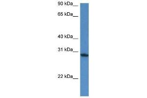 Western Blot showing Fam168a antibody used at a concentration of 1. (FAM168A antibody  (N-Term))