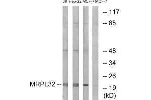 Western blot analysis of extracts from Jurkat cells, MCF-7 cells and HepG2 cells, using MRPL32 antibody.