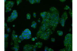 Image no. 6 for anti-V-Akt Murine Thymoma Viral Oncogene Homolog 2 (AKT2) antibody (ABIN1496564) (AKT2 antibody)