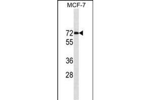 ESR1/ER Antibody (ABIN1539856 and ABIN2843829) western blot analysis in MCF-7 cell line lysates (35 μg/lane). (Estrogen Receptor alpha antibody  (AA 246-273))