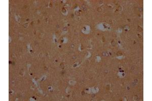 IHC image of ABIN7139952 diluted at 1:200 and staining in paraffin-embedded human brain tissue performed on a Leica BondTM system. (OR1A2 antibody  (AA 247-262))