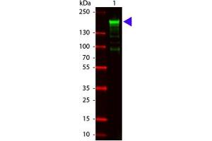 Image no. 1 for anti-alpha-2-Macroglobulin (A2M) antibody (ABIN799706) (alpha 2 Macroglobulin antibody)