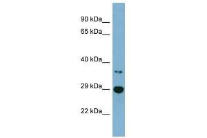 BDH2 antibody used at 1 ug/ml to detect target protein. (BDH2 antibody  (Middle Region))