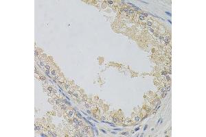 Immunohistochemistry of paraffin-embedded human prostate using NAPA antibody. (NAPA antibody)