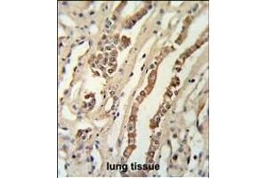 GMNN Antibody (Center ) (ABIN651420 and ABIN2840228) IHC analysis in formalin fixed and paraffin embedded lung tissue followed by peroxidase conjugation of the secondary antibody and DAB staining. (Geminin antibody  (AA 96-123))