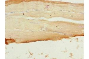 Immunohistochemistry of paraffin-embedded human skeletal muscle tissue using ABIN7169591 at dilution of 1:100