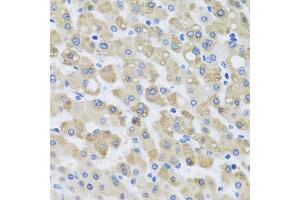 Immunohistochemistry of paraffin-embedded human liver injury using SNAP29 antibody. (SNAP29 antibody)