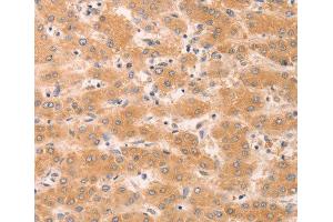 Immunohistochemistry (IHC) image for anti-Guanine Nucleotide Binding Protein (G Protein), alpha 11 (Gq Class) (GNA11) antibody (ABIN3023415) (GNA11 antibody)