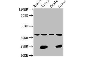 Western Blot Positive WB detected in: Rat brain tissue, Rat liver tissue, Mouse brain tissue, Mouse liver tissue All lanes: LSAMP antibody at 4. (LSAMP antibody  (AA 168-287))