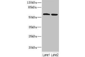 Western blot All lanes: FTCD antibody at 5. (FTCD antibody  (AA 412-541))