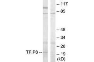 Western Blotting (WB) image for anti-Tumor Necrosis Factor, alpha-Induced Protein 8 (TNFAIP8) (AA 31-80) antibody (ABIN2879136) (TNFAIP8 antibody  (AA 31-80))