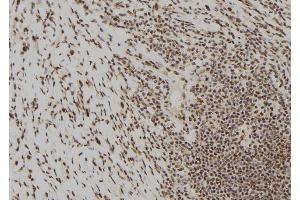 ABIN6277474 at 1/100 staining Human gastric tissue by IHC-P. (DUSP6 antibody  (C-Term))