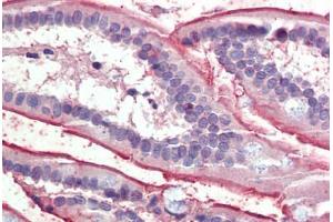 Small intestine, Human: Formalin-Fixed, Paraffin-Embedded (FFPE) (SLC5A1 antibody  (AA 458-472))