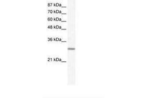 Image no. 1 for anti-General Transcription Factor IIE, Polypeptide 2 (GTF2E2) (AA 43-92) antibody (ABIN6736035) (GTF2E2 antibody  (AA 43-92))