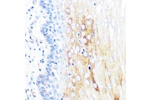 Immunohistochemistry of paraffin-embedded human esophageal using ROCK2 Rabbit mAb (ABIN7269972) at dilution of 1:100 (40x lens). (ROCK2 antibody)
