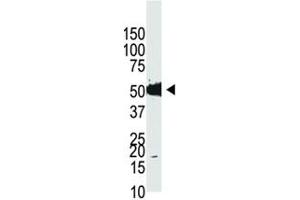 Western blot analysis of Dnmt2 antibody and HL-60 cell lysate (Dnmt2 antibody  (AA 201-230))
